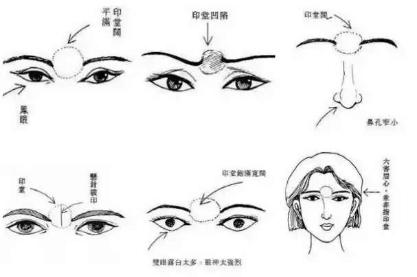 眉心八字纹怎么消除:印堂有竖纹怎么样化解