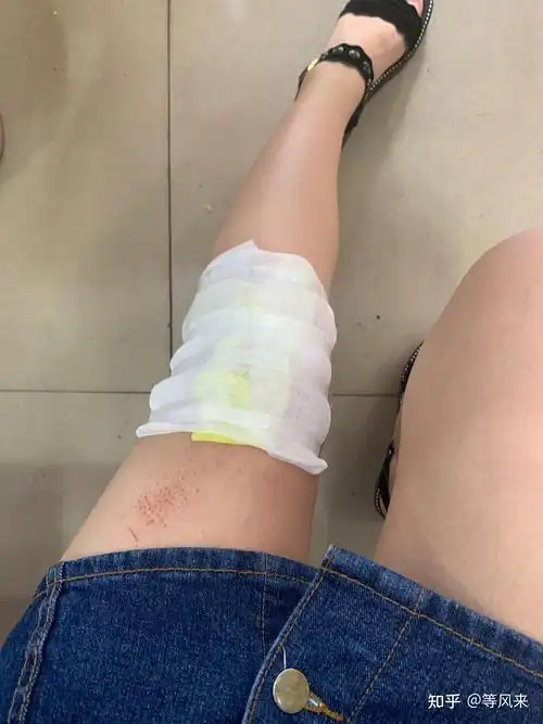 开一个膝盖腿伤恢复记录帖