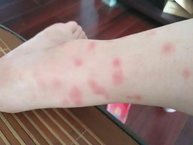 说一下天气:台风后,闷热潮湿.