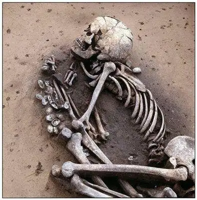 骸骨