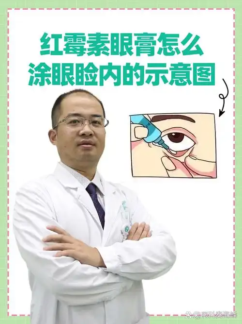 红霉素眼膏怎么涂眼睑内的示意图  涂抹红霉素眼膏前,需要做好手部和