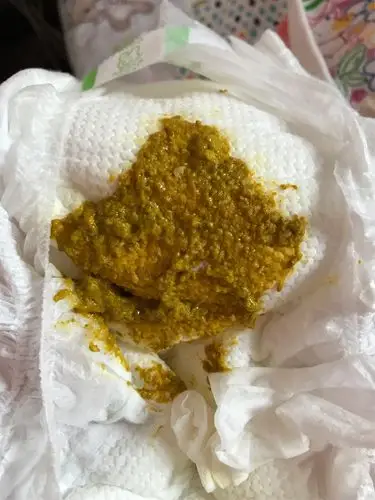 13日上午10点,之后便一次回复成水样,少量