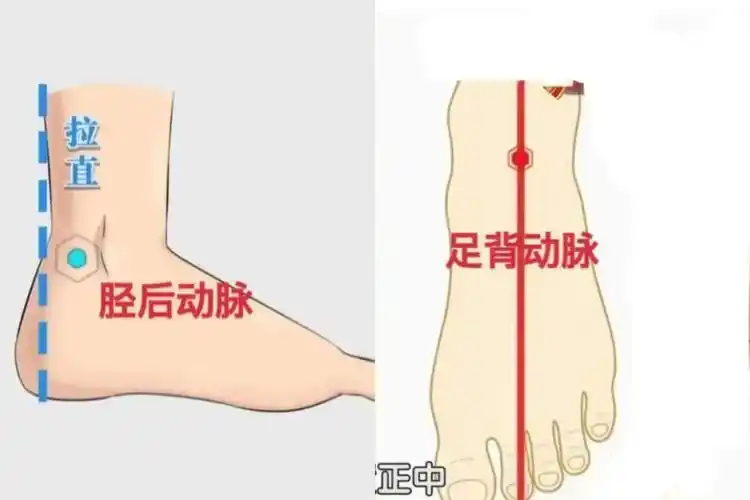 ②摸脚背上的足背动脉,或者脚内侧的胫后动脉,看看是不是随着心脏有