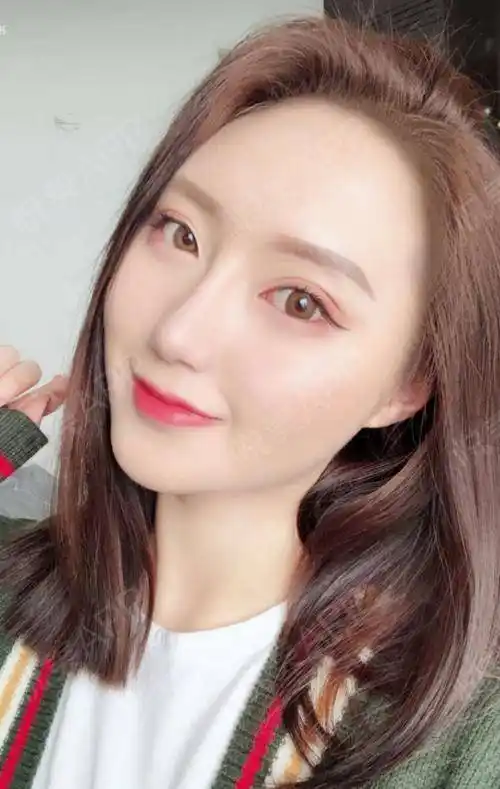 其实我对鼻梁高度要求不是太高,喜欢自然款的,我做的是鼻头抬高延长和