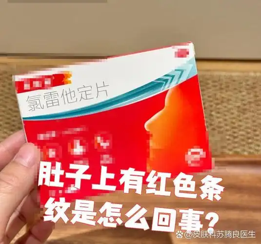 肚子上的红色条纹最常见的原因是膨胀纹,也可能是过敏反应引起的