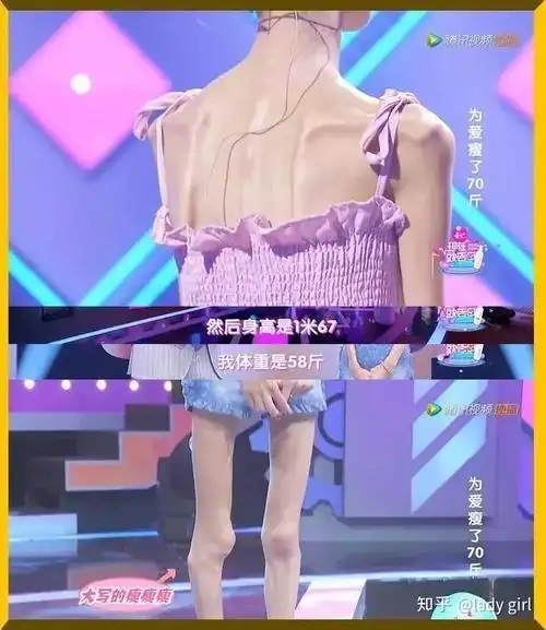 女孩为爱瘦成骷髅网友男生都喜欢这样子吗