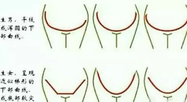 婴儿性别鉴定最新方法怀孕测男女最准的98