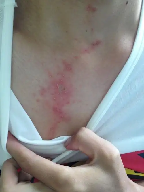 这是什么弄的,是蜘蛛尿?擦花露水还不好.