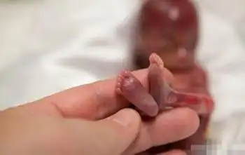 小姑娘出生时非常小