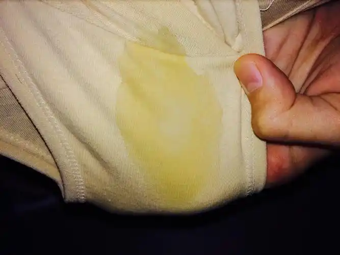 16周,阴道分泌物像水状排出 这是什么回事