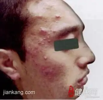 疾病大全 中医科 花柳病   性病,传统意义上是我们认为是通过性交行为