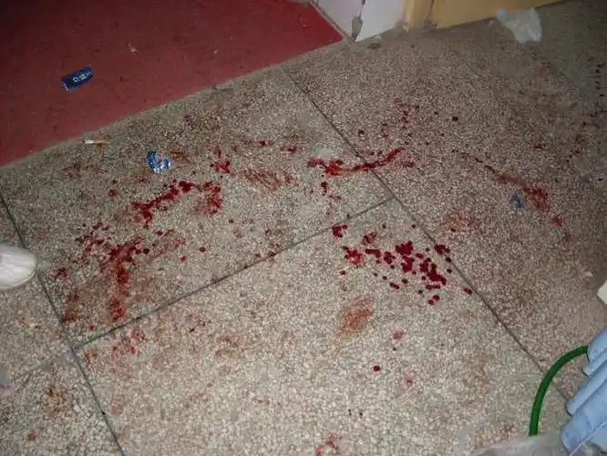 (受伤家属的血迹)