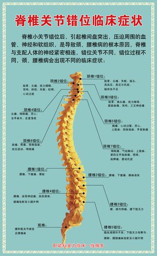 海报印制展板写真喷绘贴纸脊椎关节错位临床症状写真