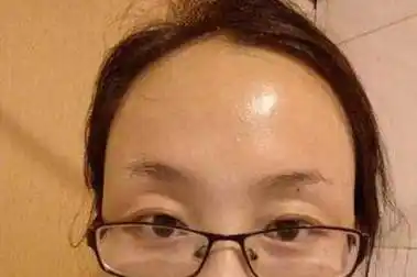 额头高额头凸的女人面相好不好