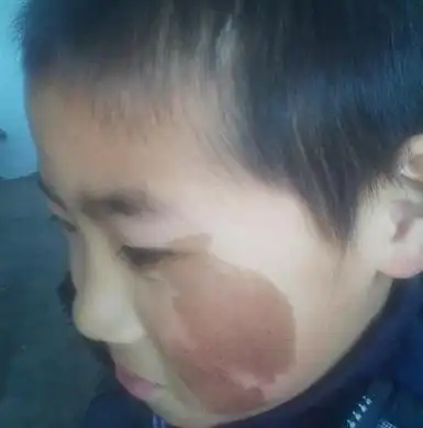 奇才奇术胎记(尾龙骨胎记位置)古人称龟尾,即依家流行俗称的尾龙骨,若