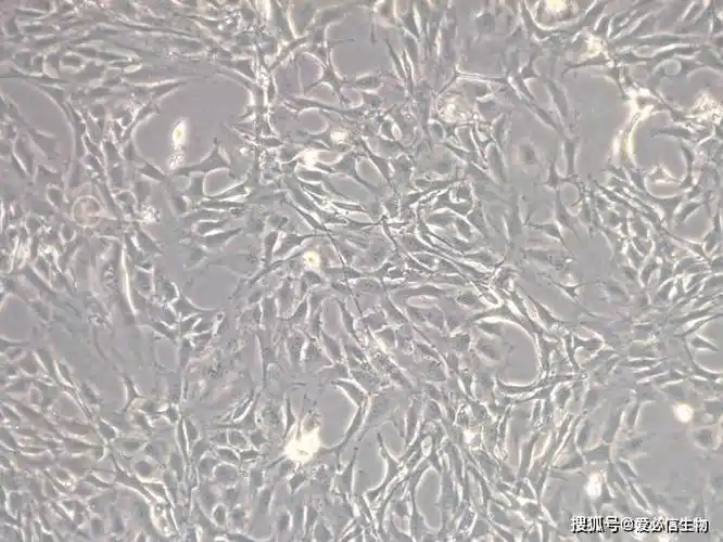 3t3-l1细胞培养及经典"鸡尾酒"诱导攻略_培养基_染色_脂肪
