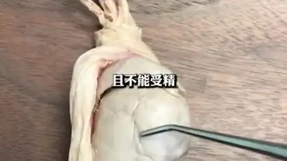 人体睾丸标本展示