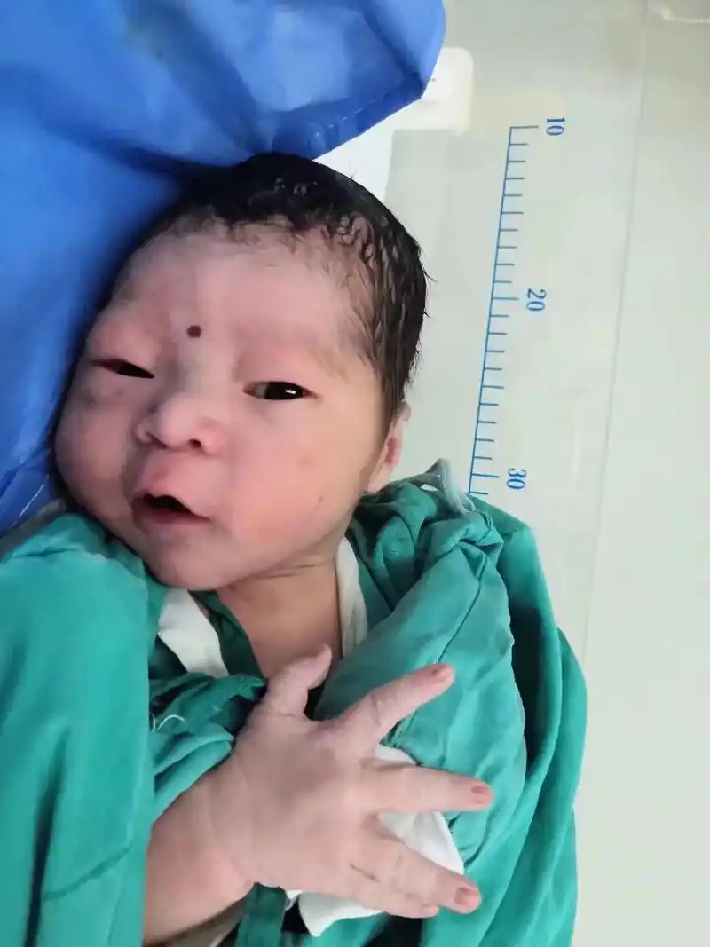 刚生下来我是不敢直视啊,养着养着看着还行,以后会