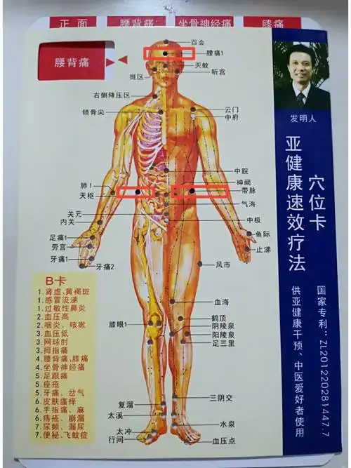 腰痛坐骨神经痛调理方法