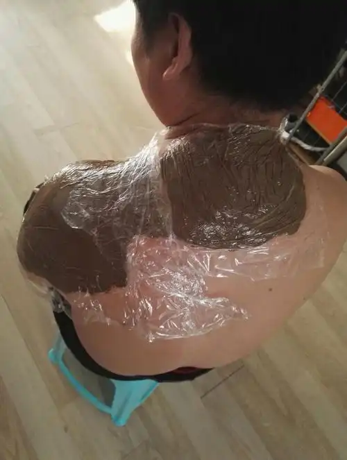 中药热敷法热敷疗法有哪些热敷的作用有什么