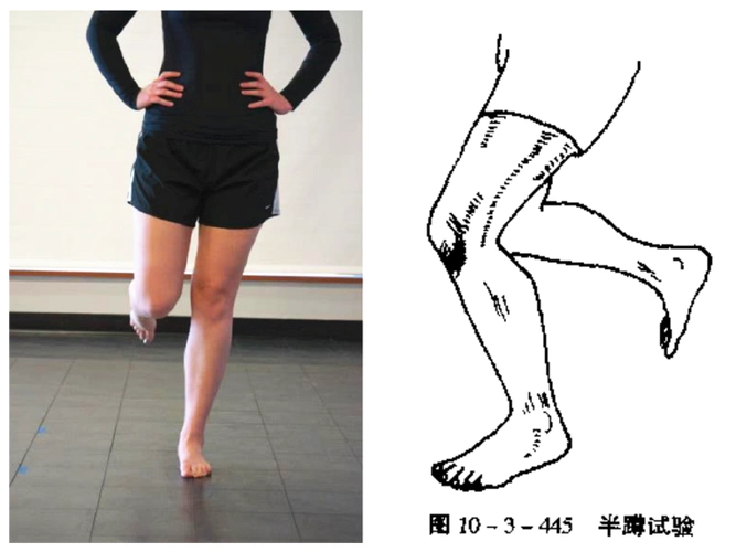一个动作提示您可能有 髌骨软化: 单腿支撑下蹲(半蹲试验):下蹲过程中