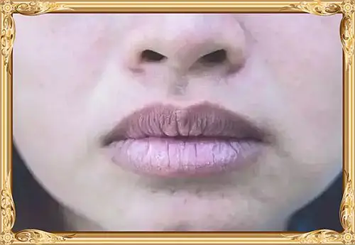 (养生)嘴唇变成这五种颜色,说明你的身体出问题了!