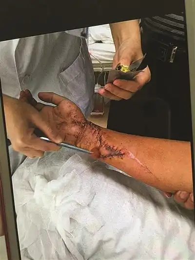 镇江康复医院骨科病床上,跟扬子晚报记者讲述8日晚自己受伤获救经历时