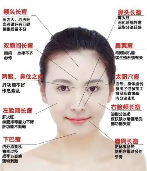 脸上不同位置长的痘,却是身体器官发出的"求救信号"