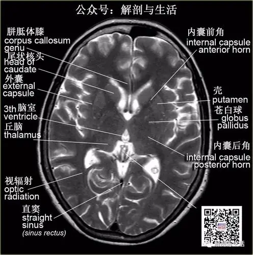 基底核基底神经节