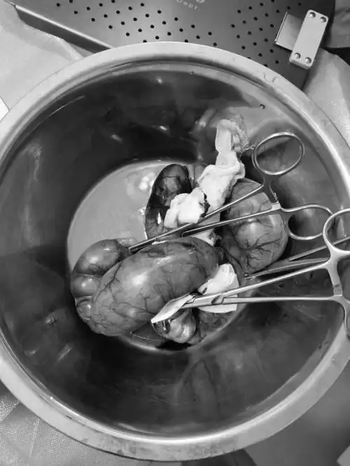 蓄脓的子宫竟有2斤重……永远不要低估你的猫猫狗狗忍痛的能力,如果没