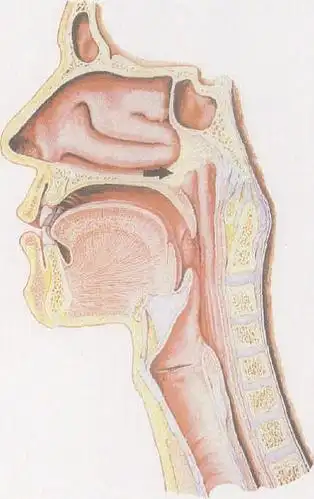 先天性后鼻孔闭锁