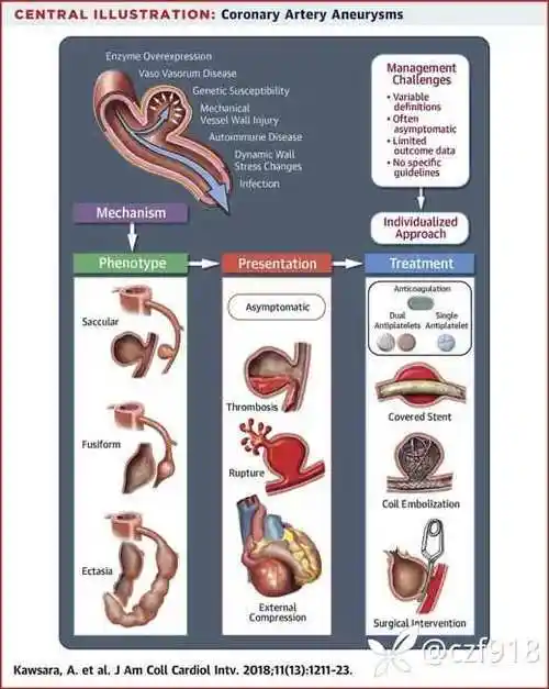 冠状动脉瘤的分型