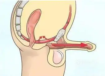 如何正确锻炼pc肌