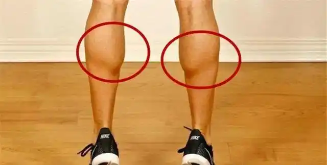 你的小腿依然很硬,捏不起来,那才是肌肉腿这类小腿叫做脂包肌,需要先