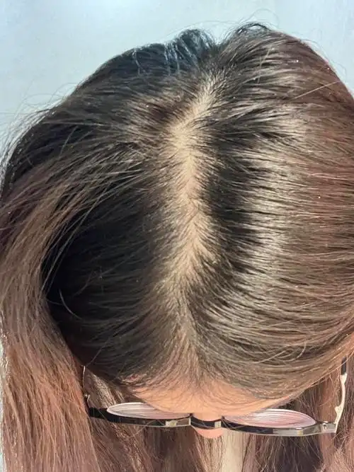 求助这样的发缝正常吗