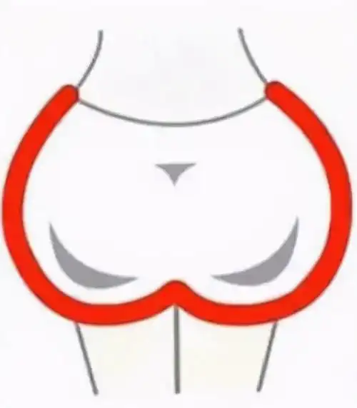 女生的臀有几种形状