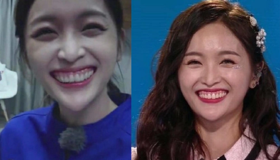 吴宣仪晒照"牙齿"又遭非议,网友再发建议,她听得进去吗?