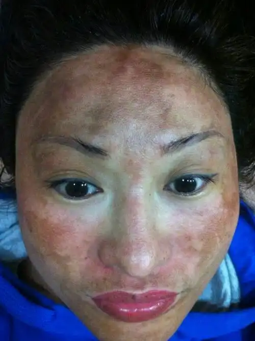 安婕语&东方李氏祛斑大王,方法马上问我