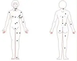 "石崇巨富痣",这个痣的位置比较难找,是在右肩胛骨最下端靠近脊椎的