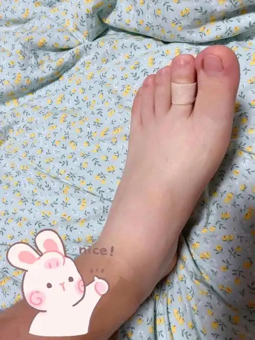 脚是越来越疼,摩擦感也越来越重,特别我还感觉我的脚趾有些弯曲变形了