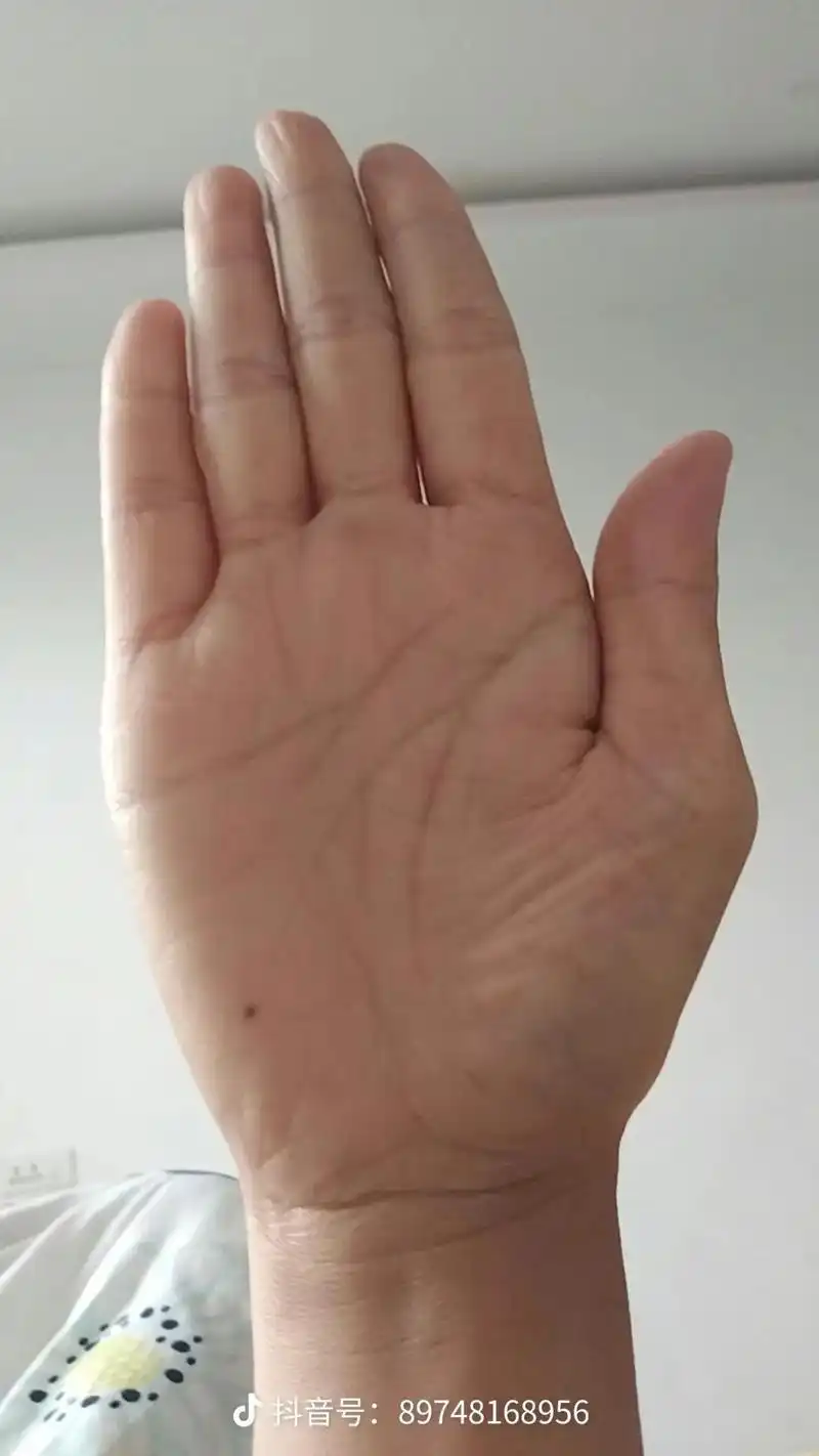 手诊手相分析:小指短小先天肾气不足;她这个感情线很特别,短而平直