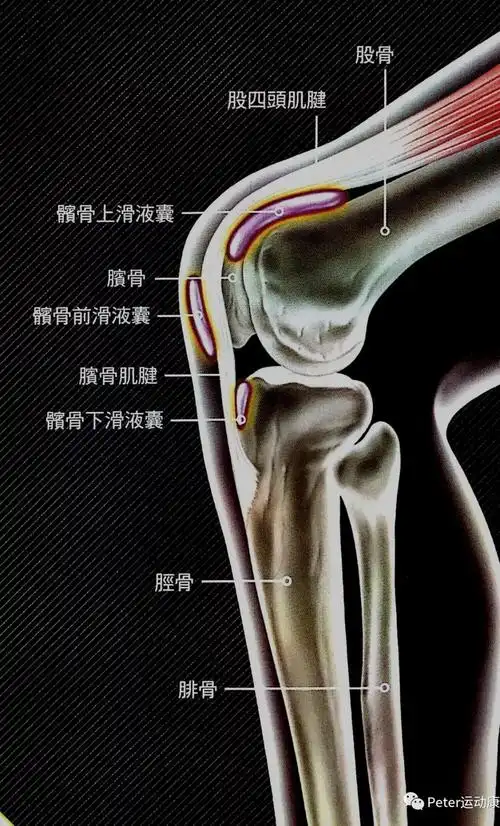 跑者膝髌前滑囊炎膝关节前侧疼不科学地跑早晚要中招
