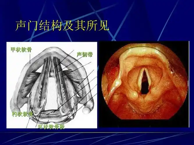 声门结构及其所见 甲状软骨 声韧带 杓状软骨 环状软骨板