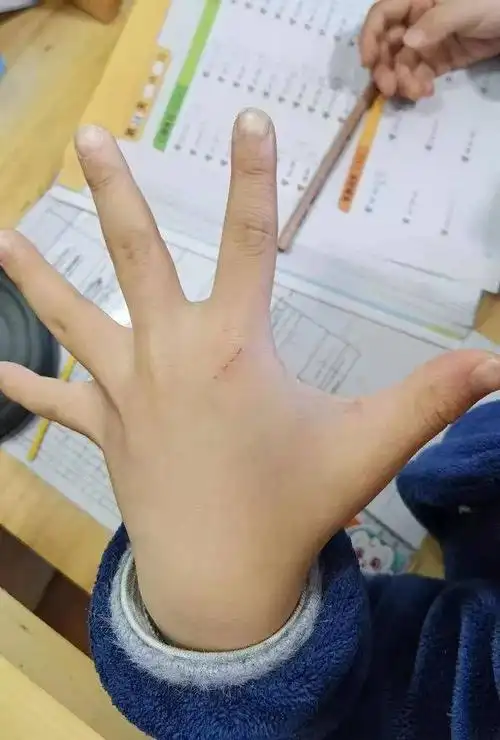 撸猫馆"喵星人"抓伤宝宝!店家说法气人