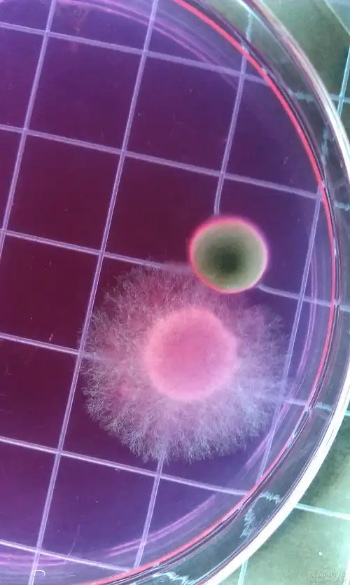 霉菌,酵母检测问题(孟加拉红培养基)