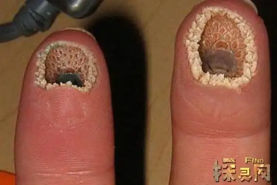 名为《传说的故乡》,这部剧讲述的是一个小女孩的故事,她的毛孔十分