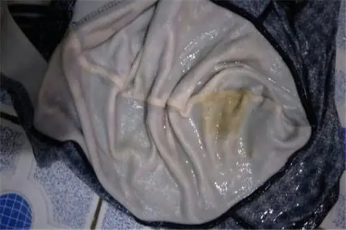 内裤发黄什么原因怎么洗