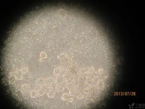 【求助】小弟,最近在样原代小鼠肝脏细胞,各位前辈帮忙看一下,培养基