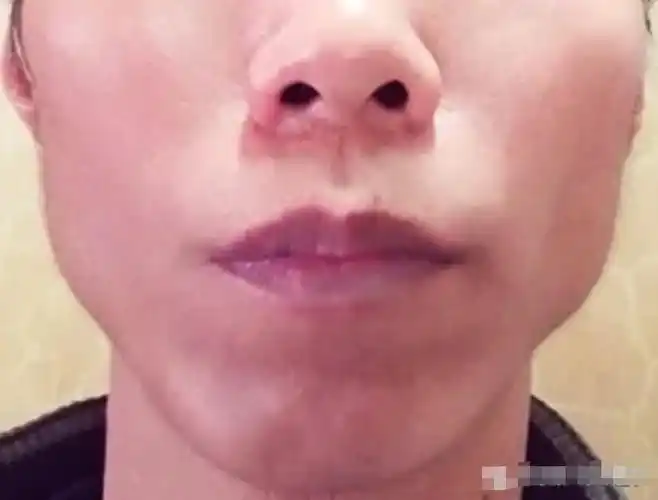 风水相术大师解析腮骨突出的面相图解