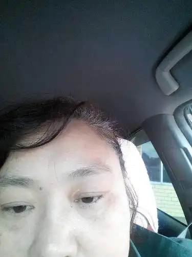 眼皮上有线状的白色斑块 有三四年了 不疼不痒 可是在继续生长 请问这